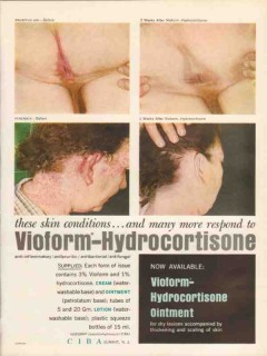 ciba 1959 vioform-hydrocortisone skin conditions medical vintage ad