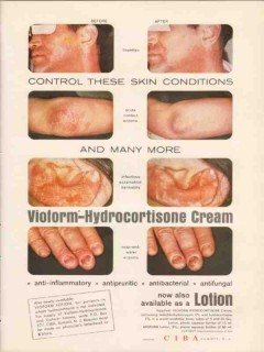ciba 1959 vioform-hydrocortisone cream lotion skin medical vintage ad